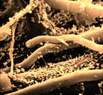 Bacteria on fungal hyphae