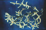 Ectomycorrhizae