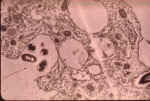 Bacteria ingested by amoeba