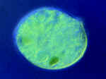 Ciliate