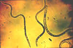 Nematodes